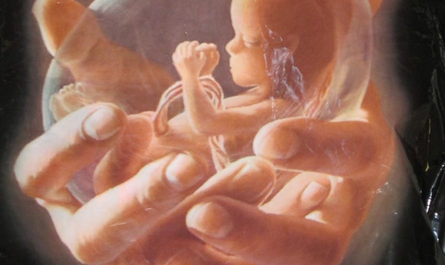 Делать ли аборт